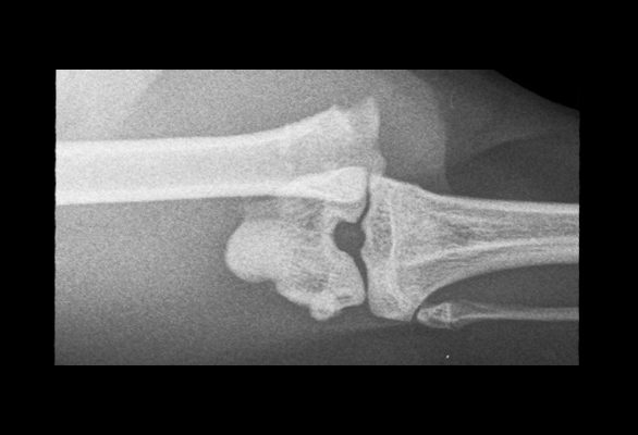 Pins Surgery Before